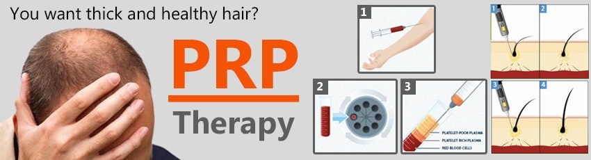 prp hair loss