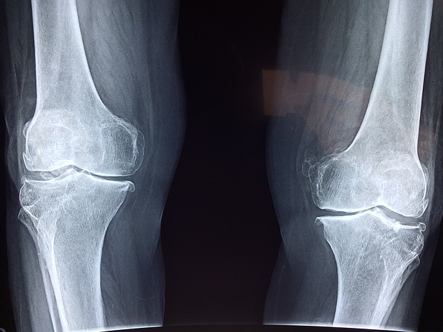 knee health