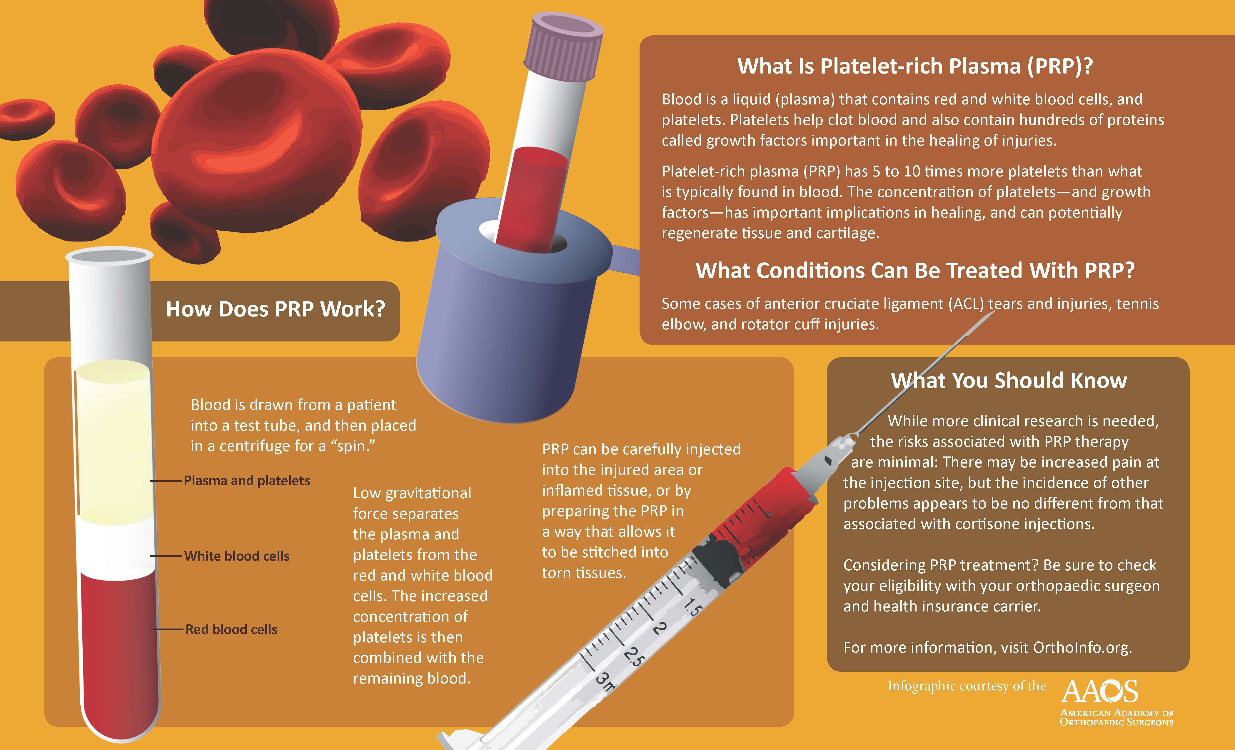 What is PRP Injection For Injury?