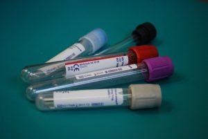 When Do I Need To Get A Blood Test?