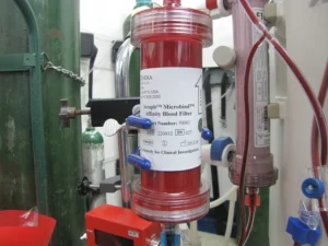 Therapeutic Plasma Exchange: Is the $30,000 "Blood Filtering" Longevity Trend Actually Backed by Science?